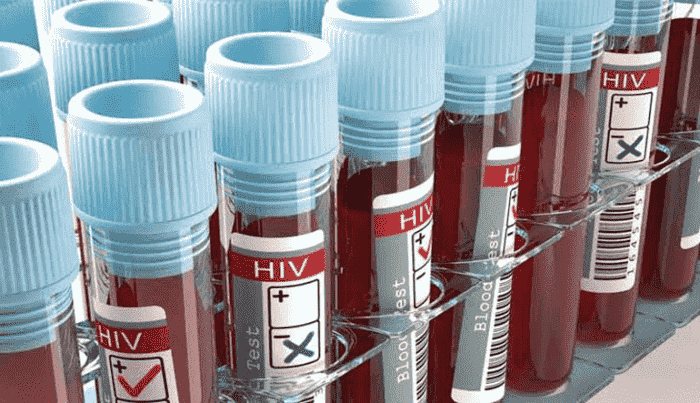 tratamento da aids frascos de sangue