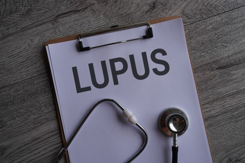 lupus eritematoso sistemico prancheta