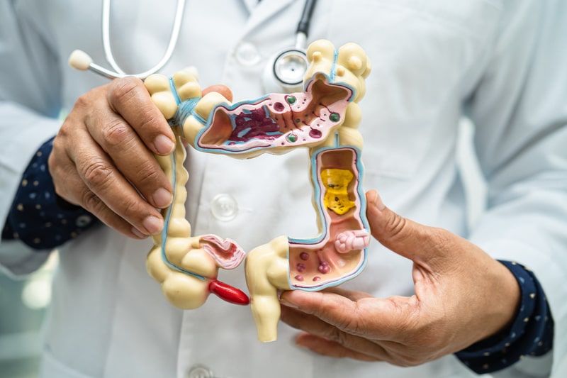 sintomas de sindrome do intestino irritavel orgao