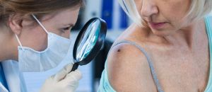 Junho Preto: a conscientização sobre o melanoma