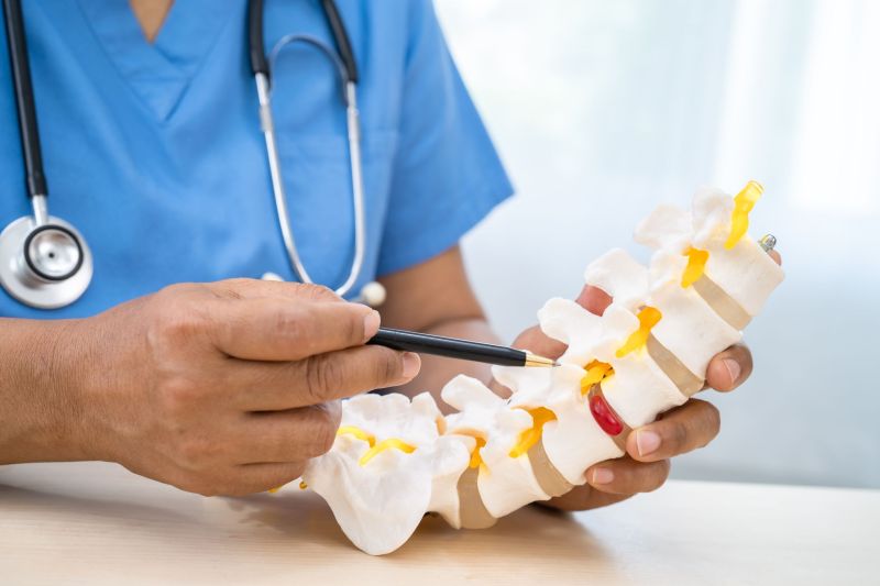 Doctor with lumbar vertebra bone skeleton and nerve model for treatment in the orthopedic department.