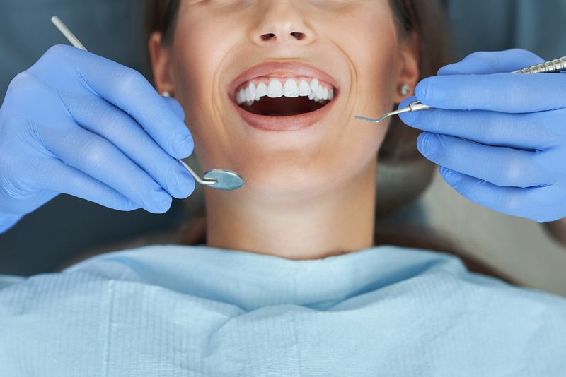 biofilme dental consulta